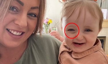 كدمة  تكشف إصابة طفلة بورم سرطاني