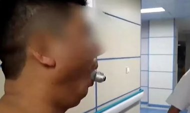 تحد على الإنترنت.. رجل يعلق مصباح كهربائي في فمه