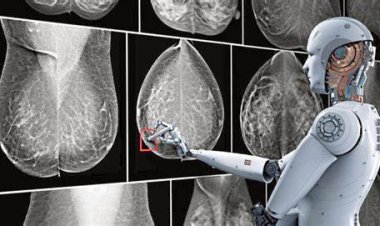 دراسة: الذكاء الاصطناعي يكشف سرطان الثدي أسرع 20% من الفحص التقليدي