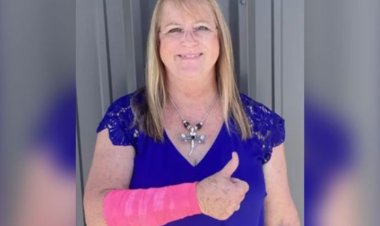 أمراة تتعرض لهجوم صقر و ثعبان في نفس اللحظة