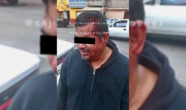 رجل يطلق عليه رصاصتين في رأسه ولم يتأذي .. ما القصة؟