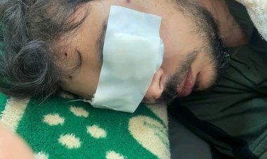 هجم عليه مسجلين خطر.. شاب يفقد عيناه الاثنين بطلق خرطوش