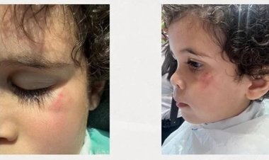 ضربوه لحد ما اتأذى نفسيًا.. سيدة تشكو من حضانة في التجمع تهمل في الأطفال