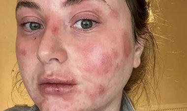 شابة إسكتلندية تقوم بعملية لتجميل الأسنان.. ما حدث لها غير متوقع