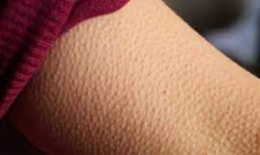 3 طرق لإزالة جلد الأوزة نهائياً