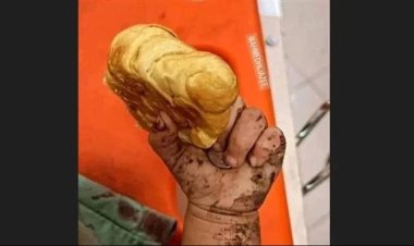 بعد مجزرة مستشفى غزة.. حقيقة وفاة الطفلة الفلسطينية الجائعة