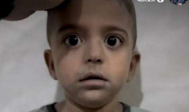 والد الطفل الفلسطيني المرتجف يكشف تفاصيل حالته الصحية