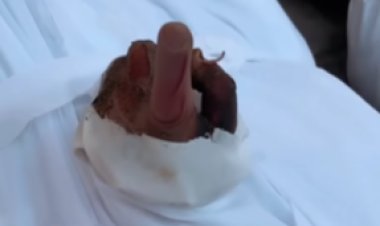 إصبعها في وضع التشهد.. جثة فلسطينية تثير دهشة كل من يراها