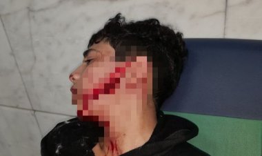 سائق توك توك يمزق وجه طالب  في دار السلام