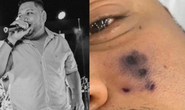 وفاة مغني برازيلي متأثراً بلدغة عنكبوت