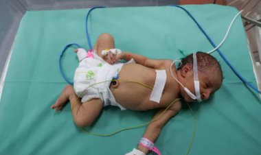 بعد تعرضهم للموت  بغزة.. من هم الأطفال الخدج؟