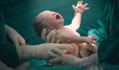 تحذيرات من زيادة كبيرة والترويج لها كتجارة.. تحرك برلماني بشأن ارتفاع نسبة الولادة القيصرية في مصر