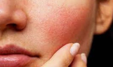 تعرفي على أفضل نظام للبشرة الحساسة