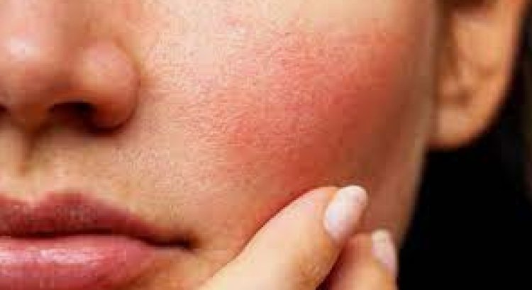 تعرفي على أفضل نظام للبشرة الحساسة