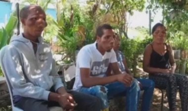 ظهور حالة وراثية غريبة تجعل عائلة في الدومنيكان يُشبهون المخلوقات الفضائية