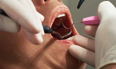 منظف ​​عيادة أسنان ينتحل شخصية طبيب ويخلع أسنان رجل