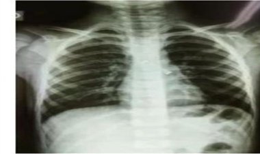 مستشار وزير الصحة: إطلاق أول منصة تحتفظ بأشعة المرضى في مصر مجانًا قريبًا