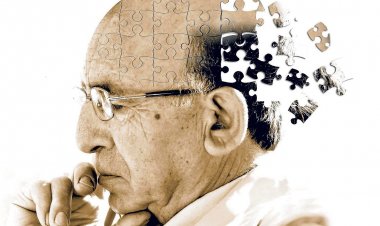 يزيل البروتينات من الدماغ.. اليابان تطلق دواء جديد لـ الزهايمر (تفاصيل)