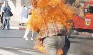 مريض نفسي يشعل النيران في جسده ببولاق الدكرور