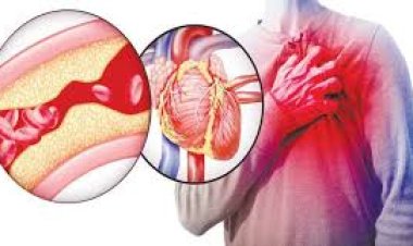 مخاطر تجلط الدم.. سيناريوهات تهدد الصحة والوقاية الممكنة