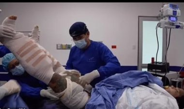 تحول حلم الطول إلى كابوس.. معاناة يفرسون كوسيو بعد عملية الإطالة الجراحية «أعرف الحكاية»