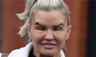 كيري كاتونا تثير الجدل بظهور جديد بعد عملية رفع العينين