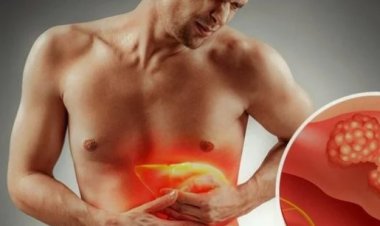 نصائح للحفاظ على  الكبد.. أهتم بصحتك