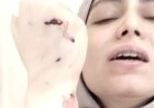 إصابات بالغة لطبيبة أسنان بعد الاعتداء عليها داخل مركز طبي بشبرا الخيمة
