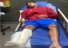 بعد كسر ساقه أمام الزمالك.. جراحة عاجلة للاعب بترول أسيوط