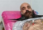 حسن الهلالي يستعد لإجراء جراحة بالمثانة ويطلب الدعاء من جمهوره