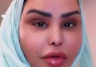 أول ظهور للمطربة الإماراتية أحلام  بعد نجاح عملية شد الوجه