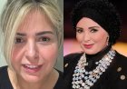 صابرين تكشف معاناتها خلال فترة ارتداء الباروكة: كنت تايهة ومنكمشة وخايفة من كلام الناس