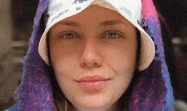 رحمة حسن تكشف تعرضه لأزمة في عيادة تجميل :اتخدعت  وتساقط شعري مستمر منذ عامين