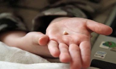 تفسير حلم سقوط الأسنان في اليد بدون ألم