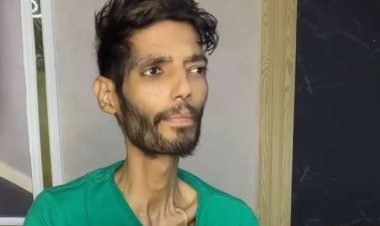 بعد تدهور حالته ونقله للرعاية المركزة.. إبراهيم شيكا في رسالة لمتابعيه: «محدش يتصل بيا»