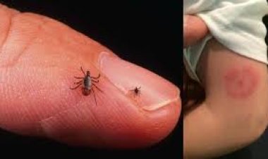 موسم القراد الخطر الخفي يتجلى مع اقتراب الربيع