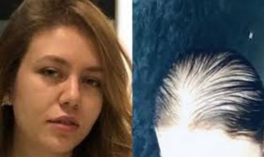 بعد تعرضها للصلع.. رحمة حسن تكشف عن تطورات حالتها الصحية