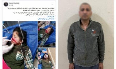 خلاف على محصول أرض زراعية يتنهى بتمزيق وجه صغيرة باستخدام ساطور 
