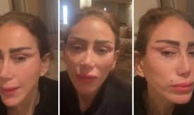 «مش عارفة أعيش».. ريهام سعيد تفتح النار على طبيب التجميل اللبناني