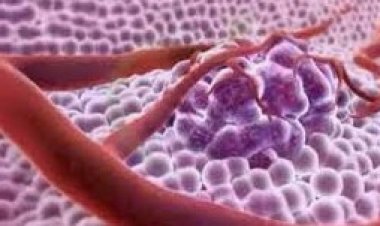 تعرف على طرق الوقاية من السرطان