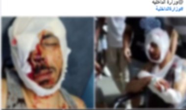 الأمن يكشف ملابسات تمزيق جسد مسجل خطر على يد آخر في الإسكندرية 