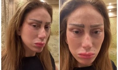 بعد فشل عملية التجميل.. ريهام سعيد تستغيث: مفيش دكتور يرجعني بني آدمة