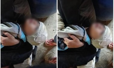 ضبط سيدة استغلت حفيدها المصاب ظاهريًا في التسول بشبرا الخيمة