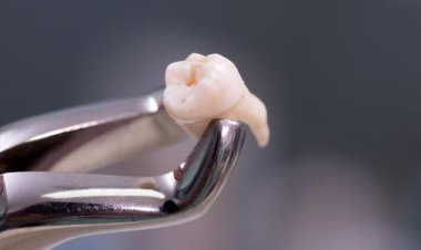 تفسير خلع الضرس في المنام