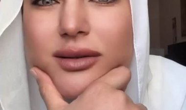 سما المصري تستغيث: «تعبت من العلاج ومفيش حل لالتهاب أوتار القدمين»