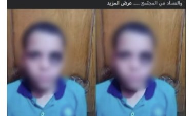 كشف حقيقة منشور عن تعدي معلمة على طالب بالإسماعيلية.. خبط في دكة خشبية وادعى أن معلمته ضربته خوفاً من أمه