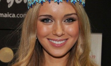 بسبب ظبى.. مصرع الروسية كسينيا ألكساندروفا ملكة جمال العالم السابقة