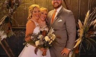 زواج أشهر توأم ملتصق في العالم