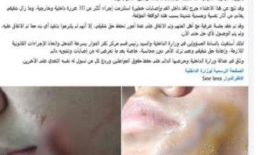 ضبط طالب اعتدى على زميله بقطعة زجاج وأصابه في وجهه بالبحيرة