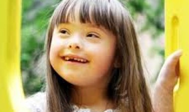 في يومها العالمي.. معلومات مهمة عن متلازمة داون